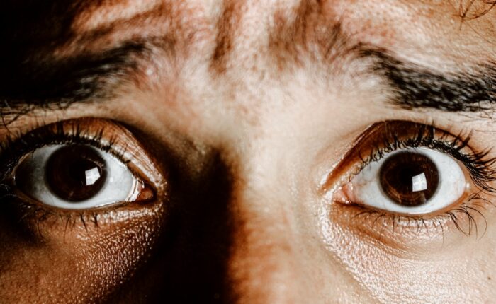 Nahaufnahme weit geöffneter Augen mit ängstlichem Blick.